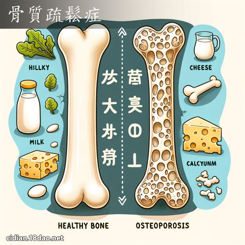 骨質疏鬆症 - 國語辭典配圖